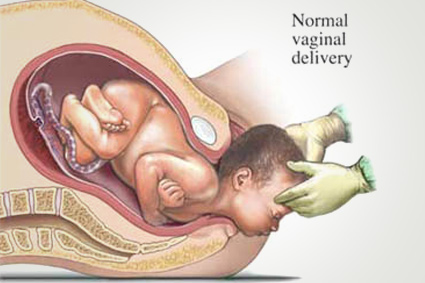 Normal Baby Delivery